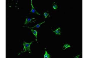 Immunofluorescent analysis of U251 cells using ABIN7172399 at dilution of 1:100 and Alexa Fluor 488-congugated AffiniPure Goat Anti-Rabbit IgG(H+L)