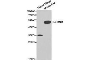Western Blotting (WB) image for anti-LETM1 Domain Containing 1 (LETMD1) antibody (ABIN1873537) (LETMD1 anticorps)