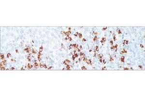 Image no. 1 for Rabbit anti-Human IgD (Chain delta) antibody (ABIN952831) (Lapin anti-Humain IgD (Chain delta) Anticorps)