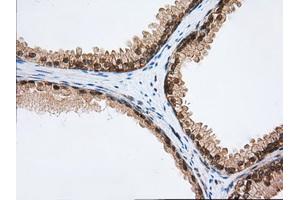 Immunohistochemical staining of paraffin-embedded Human Kidney tissue using anti-PDE4A mouse monoclonal antibody. (PDE4A anticorps)