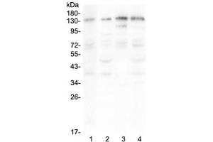 Western blot testing of human 1) A375, 2) HepG2, 3) Jurkat and 4) PANC-1 lysate with EPS15 antibody at 0. (EPS15 anticorps)