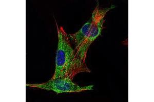 Immunofluorescence analysis of PANC-1 cells using INHA mouse mAb (green). (Inhibin alpha anticorps)
