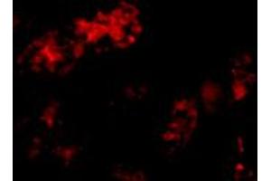Immunofluorescence of BMF in human kidney tissue with BMF polyclonal antibody  at 10 ug/mL . (BMF anticorps  (C-Term))