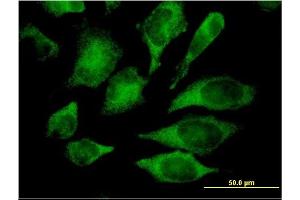 Immunofluorescence of monoclonal antibody to MAPK13 on HeLa cell.