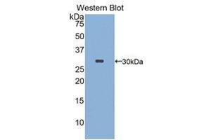 Western Blotting (WB) image for anti-FK506 Binding Protein 10, 65 KDa (FKBP10) (AA 316-573) antibody (ABIN1858893)