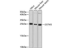 Western blot analysis of extracts of various cell lines, using GSTM3 antibody (ABIN1680137, ABIN3018259, ABIN3018260 and ABIN6220417) at 1:3000 dilution. (GSTM3 anticorps  (AA 101-225))