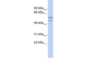 WB Suggested Anti-SOHLH2 Antibody Titration:  0.