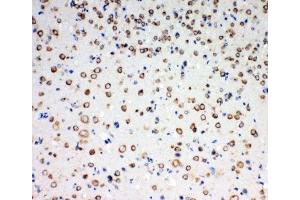 IHC-P: TrkC antibody testing of rat brain tissue