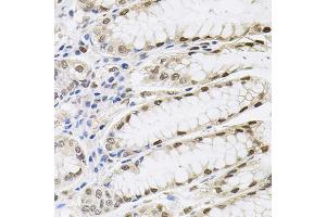 Immunohistochemistry of paraffin-embedded human stomach using SRSF9 antibody (ABIN5973601) (40x lens).