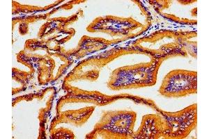 Immunohistochemistry of paraffin-embedded human prostate tissue using ABIN7170044 at dilution of 1:100 (ATP1B1 anticorps  (AA 64-241))