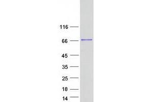 Validation with Western Blot