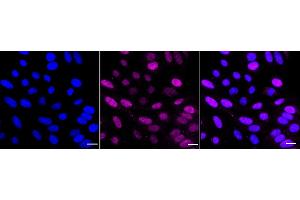 Immunocytochemical staining of HepG2 cells with RAD23A antibody (ABIN7800116), 1:1,000). (Recombinant RAD23A anticorps)