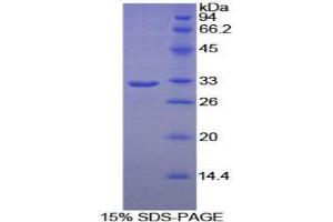 SDS-PAGE analysis of Human PLA2R1 Protein.