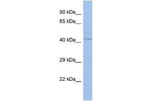 Host: Rabbit Target Name: ZNF362 Sample Type: OVCAR-3 Whole cell lysates Antibody Dilution: 1. (ZNF362 anticorps  (C-Term))