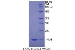 SDS-PAGE analysis of Human DDT Protein.