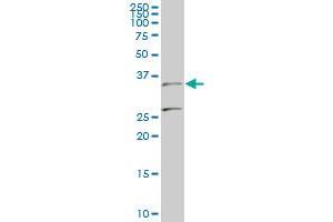 BARHL1 monoclonal antibody (M01), clone 2B11 Western Blot analysis of BARHL1 expression in PC-12 . (BARHL1 anticorps  (AA 55-154))