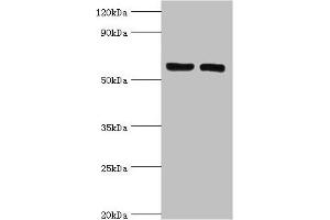 Western blot All lanes: ADP-ribosylation factor-binding protein GGA2 antibody at 10 μg/mL Lane 1: Rat brain tissue Lane 2: Mouse liver tissue Secondary Goat polyclonal to rabbit IgG at 1/10000 dilution Predicted band size: 67 kDa Observed band size: 67 kDa