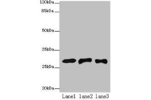 Western blot All lanes: ETHE1 antibody at 8 μg/mL Lane 1: Mouse liver tissue Lane 2: HepG2 whole cell lysate Lane 3: Hela whole cell lysate Secondary Goat polyclonal to rabbit IgG at 1/10000 dilution Predicted band size: 28 kDa Observed band size: 28 kDa
