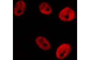 ABIN6276281 staining  Hela cells by IF/ICC. (STAT1 anticorps  (C-Term))