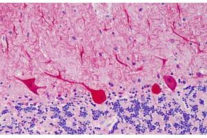 Human Cerebellum: Formalin-Fixed, Paraffin-Embedded (FFPE) (CARD11 anticorps  (AA 18-238))