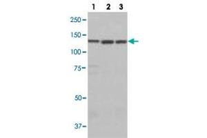 Western blot analysis of lane 1: A549 cell lysate, lane 2: HEK293 cell lysate and lane 3: HeLa cell lysate using LARS polyclonal antibody .