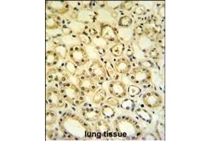 H6PD Antibody (C-term) (ABIN651229 and ABIN2840142) IHC analysis in formalin fixed and paraffin embedded lung tissue followed by peroxidase conjugation of the secondary antibody and DAB staining. (Glucose-6-Phosphate Dehydrogenase anticorps  (C-Term))