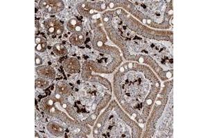 Immunohistochemical staining of human duodenum with SLC22A16 polyclonal antibody  shows moderate cytoplasmic positivity in glandular cells at 1:200-1:500 dilution.