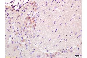 Formalin-fixed and paraffin embedded rat brain labeled with Rabbit Anti BBC3/PUMA Polyclonal Antibody, Unconjugated (ABIN731528) at 1:200 followed by conjugation to the secondary antibody and DAB staining (PUMA anticorps  (AA 131-180))