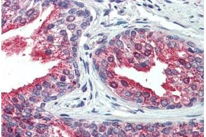 Human, Prostate: Formalin-Fixed Paraffin-Embedded (FFPE)