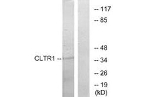Western blot analysis of extracts from COS7 cells, using CLTR1 Antibody. (CysLTR1 anticorps  (AA 131-180))