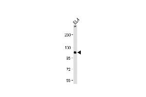 Anti-TCIRG1 Antibody (C-Term) at 1:2000 dilution + EL4 whole cell lysate Lysates/proteins at 20 μg per lane. (TCIRG1 anticorps  (AA 668-702))