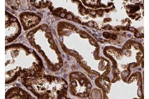 ABIN6272433 at 1/100 staining Human kidney tissue by IHC-P. (SPHK2 anticorps  (N-Term))