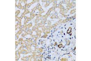 Immunohistochemistry of paraffin-embedded human liver using CSH1 antibody (ABIN5971023) at dilution of 1/100 (40x lens).