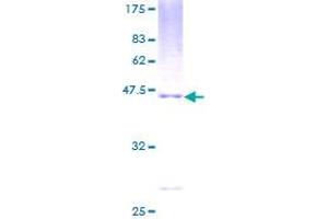 Image no. 1 for Pro-Melanin-Concentrating Hormone (PMCH) (AA 1-165) protein (GST tag) (ABIN1315509)