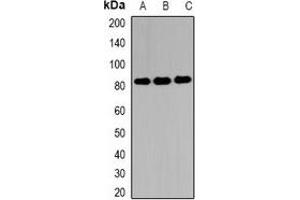 Western blot analysis of EIF4B expression in MCF7 (A), 22RV1 (B), Hela (C) whole cell lysates. (EIF4B anticorps)