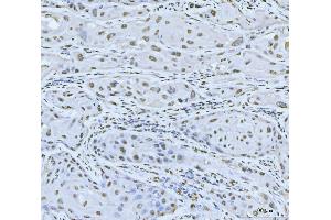 IHC analysis of MRE11 using anti-MRE11 antibody (ABIN7600025). (Mre11 anticorps  (AA 14-481))