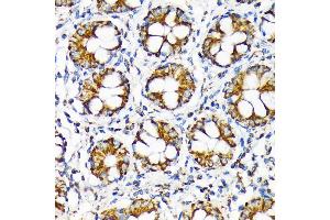 Immunohistochemistry of paraffin-embedded human colon using TOMM22 Rabbit mAb (ABIN7270930) at dilution of 1:100 (40x lens). (TOMM22 anticorps)