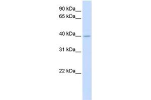 WB Suggested Anti-SRD5A3 Antibody Titration:  0. (SRD5A3 anticorps  (N-Term))