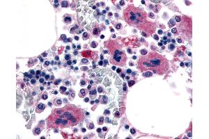 Anti-P2RY12 / P2Y12 antibody IHC of human bone marrow, megakaryocytes.