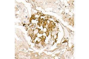 Immunohistochemistry of paraffin-embedded rat heart using α-Tubulin Rabbit mAb (ABIN7271036) at dilution of 1:100 (40x lens).