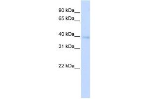 WB Suggested Anti-HOXA11 Antibody Titration: 0. (Homeobox A11 anticorps  (Middle Region))