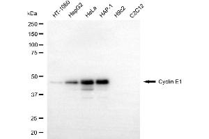 Western blotting analysis using cyclin E1 antibody (ABIN7798198). (Recombinant Cyclin E1 anticorps)