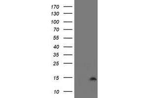 Image no. 1 for anti-Cystatin SA (CST2) antibody (ABIN1497757) (CST2 anticorps)