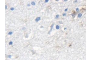 Detection of KRT33A in Human Cerebrum Tissue using Polyclonal Antibody to Keratin 33A (KRT33A)