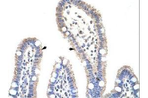 Image no. 1 for anti-Methyltransferase Like 3 (METTL3) (N-Term) antibody (ABIN202783) (METTL3 anticorps  (N-Term))