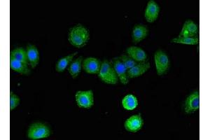 Immunofluorescent analysis of HepG2 cells using ABIN7145448 at dilution of 1:100 and Alexa Fluor 488-congugated AffiniPure Goat Anti-Rabbit IgG(H+L)