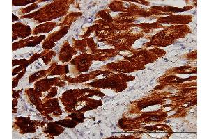 Immunoperoxidase of monoclonal antibody to TNNC1 on formalin-fixed paraffin-embedded human heart.