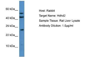 Host: Rabbit Target Name: Hdhd2 Sample Type: Rat Liver lysates Antibody Dilution: 1. (HDHD2 anticorps  (N-Term))