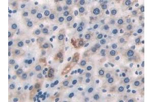 Detection of DLD in Rat Liver Tissue using Polyclonal Antibody to Dihydrolipoyl Dehydrogenase (DLD) (DLD anticorps)