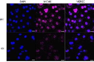 Immunocytochemical staining of HeLa cells using MCM6 antibody (ABIN7799421), 1:1,000), Top panel: wild-type (WT), Bottom panal: MCM6 shRNA knockdown (KD). (Recombinant MCM6 anticorps)